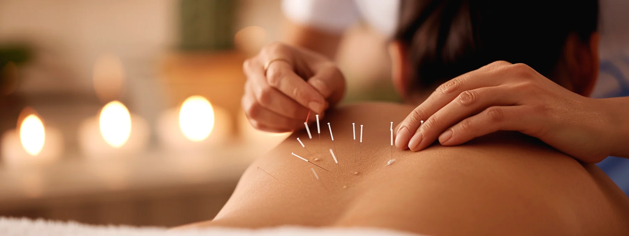 Acupuncture Clinical Perspective
